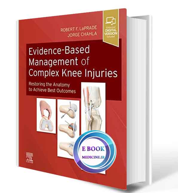 دانلود کتاب Evidence-Based Management of Complex Knee Injuries: Restoring the Anatomy to Achieve Best Outcomes 1st 2020 ( PDF)